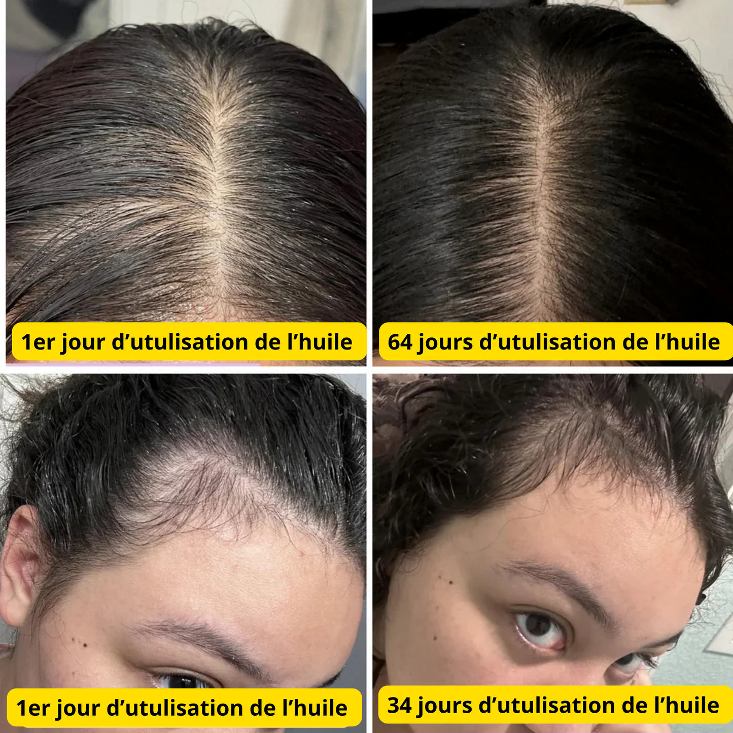 Huile de Croissance Naturelle