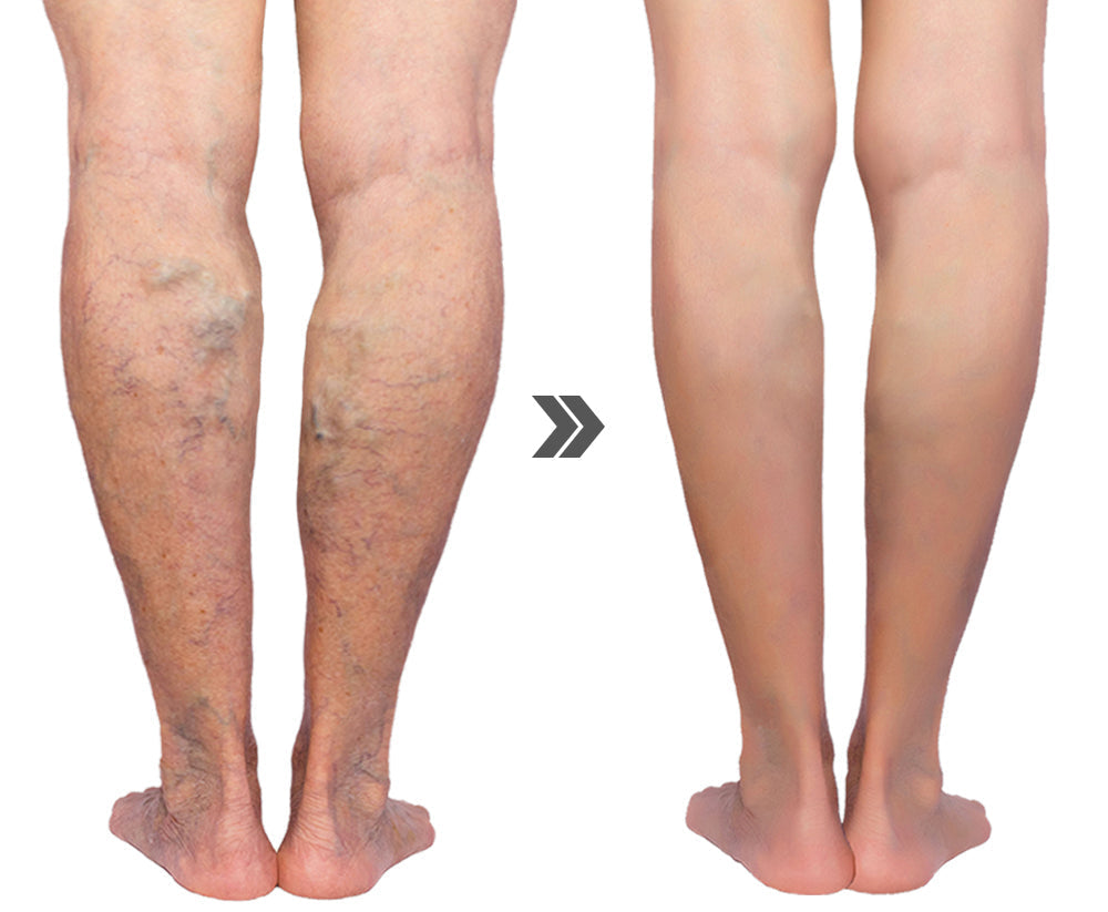 Patchs nettoyants et purifiants le corps